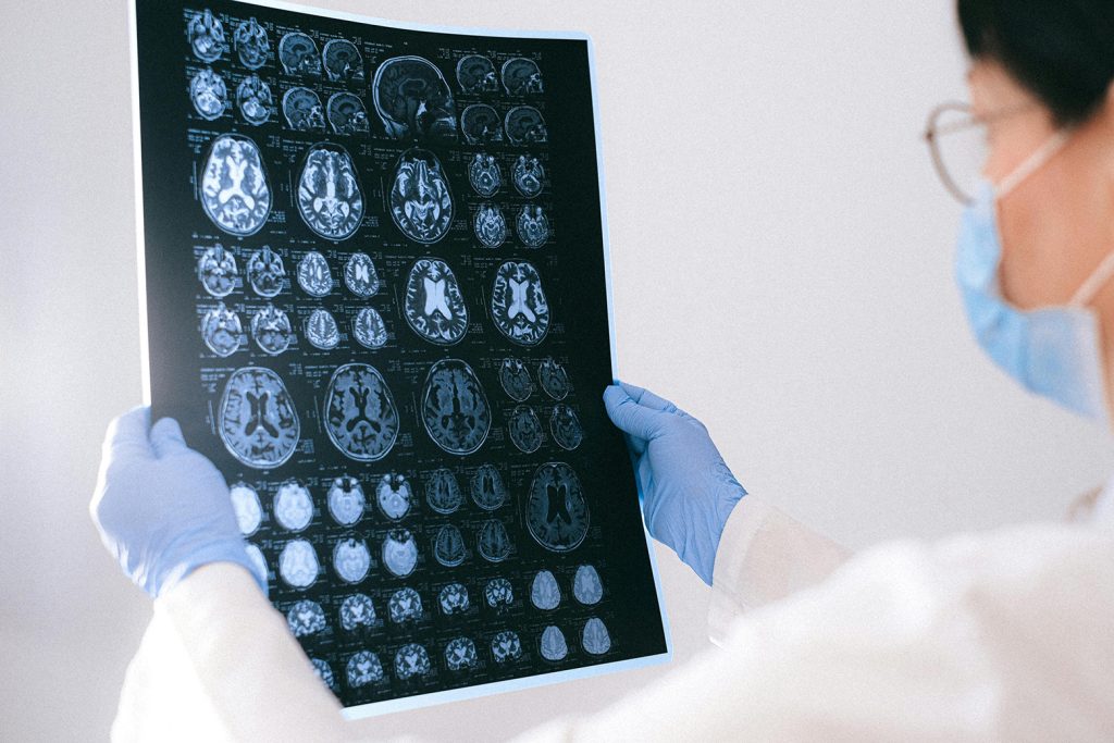 Medical professional looks at a brain scan xrays